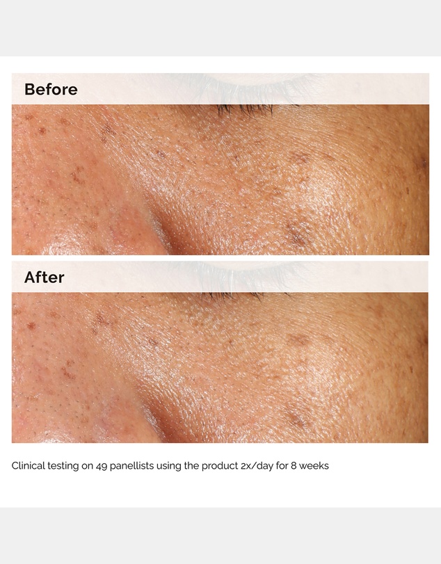 The Ordinary - Alpha Arbutin 2% + HA - 60ml