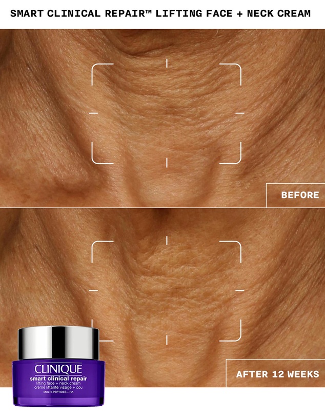 Clinique - Smart Clinical Repair Lifting Face + Neck Cream