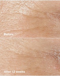Clinique - Smart Clinical Repair Wrinkle Correcting Cream
