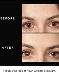 FOREO - Complete Wrinkle Repair Program