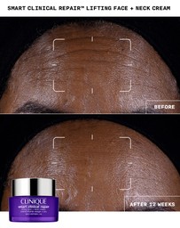 Clinique - Smart Clinical Repair Lifting Face + Neck Cream