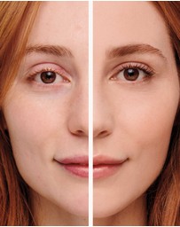 Jane Iredale - Amazing Base® Loose Mineral Powder (SPF 20)