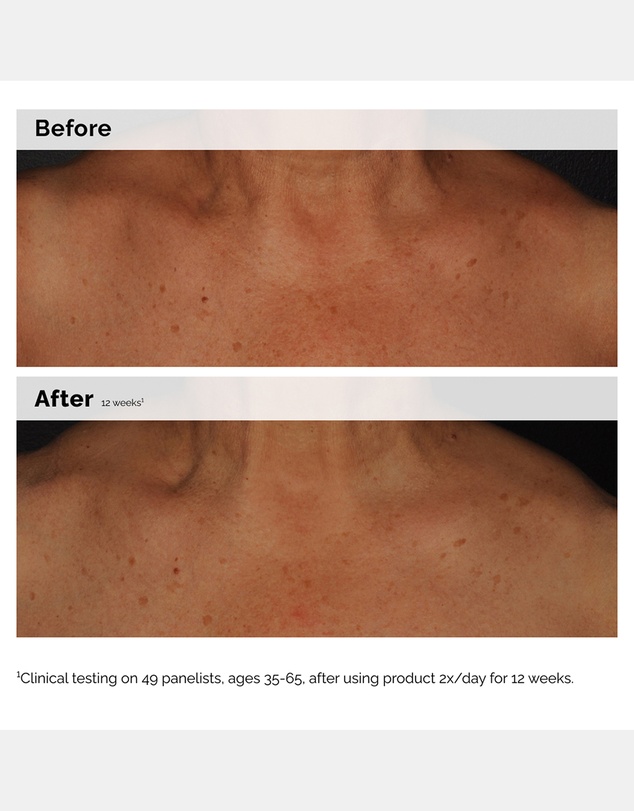 The Ordinary - Niacinamide 5% Face and Body Emulsion