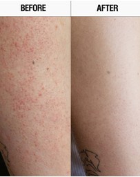 Grown Alchemist - Resurfacing Targeted Body Cleanser