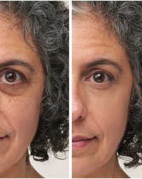 Jane Iredale - Enlighten Plus™ Under-eye Concealer