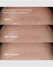 Clinique - Anti-Aging Routine: Mini Smart Clinical Repair Kit
