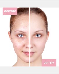 MCoBeauty - Glow Boost Vitamin C Serum 30ml