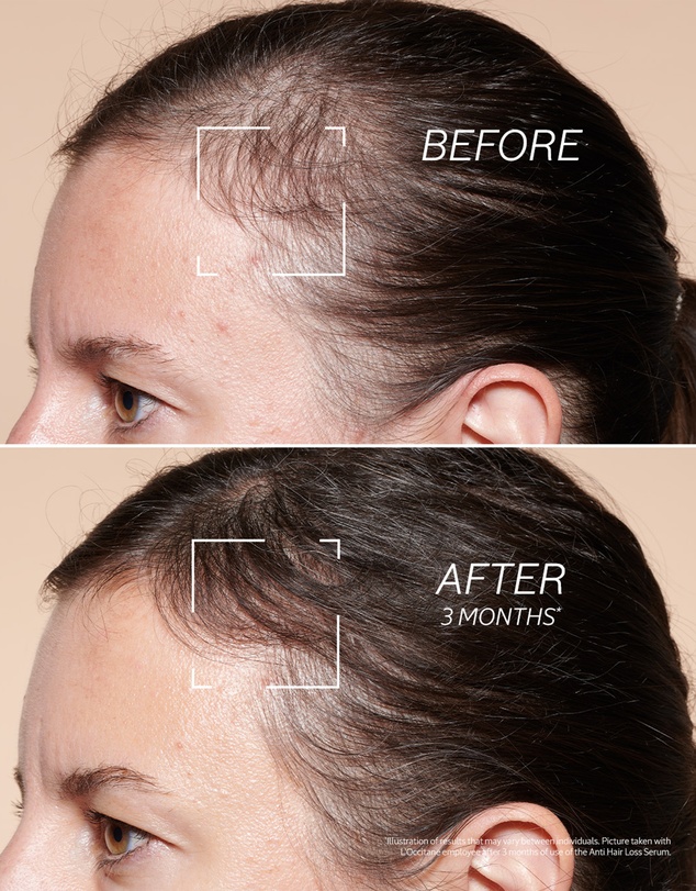 L'Occitane - Anti-Hair Loss Serum 50Ml