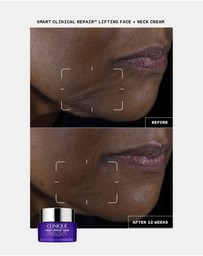 Clinique - Smart Clinical Repair Lifting Face + Neck Cream