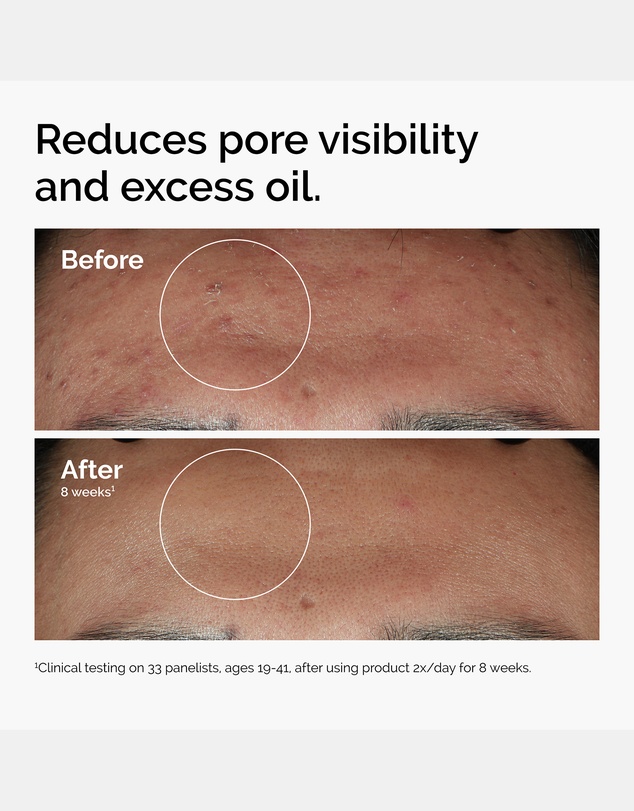 The Ordinary - Niacinamide 10% + Zinc 1% 30ml