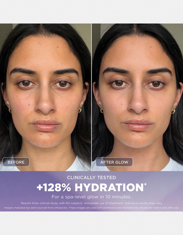 Shark Beauty - Shark FacialPro Glow At Home Hydro-Powered Facial System