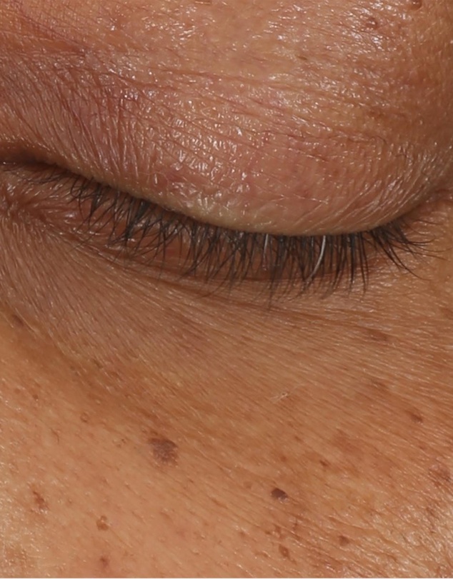 Clinique - All About Eyes Brightening Serum Concentrate