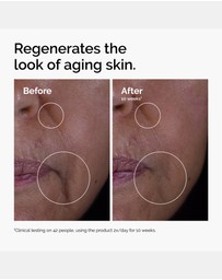 The Ordinary - GF 15% Solution