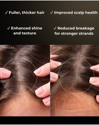 FOREO - FAQ Scalp Recovery & Thick Hair Probiotic Serum