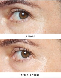 Ole Henriksen - Double Rewind 0.3% Pro-Grade Retinol Serum