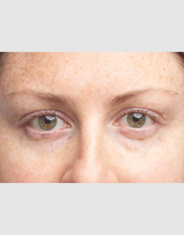 Clinique - All About Eyes Brightening Serum Concentrate