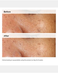 The Ordinary - Alpha Arbutin 2% + HA - 60ml