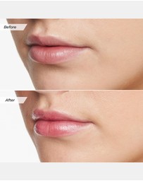MCoBeauty - Glow Lip Balm - Watermelon
