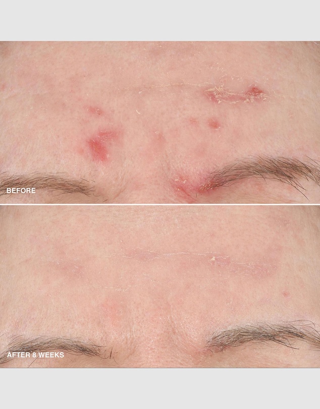 Bobbi Brown - Vitamin Enriched Smoothing Serum