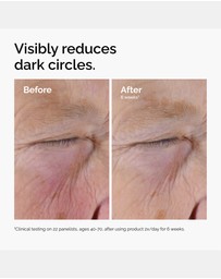 The Ordinary - Caffeine Solution 5% + EGCG