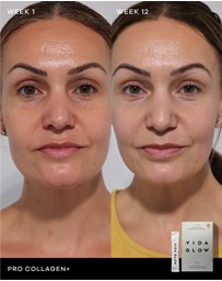 Vida Glow - Pro Collagen+