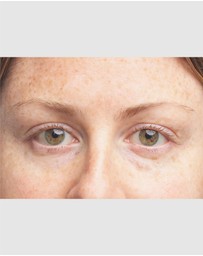 Clinique - All About Eyes Brightening Serum Concentrate