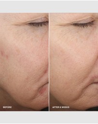 Bobbi Brown - Vitamin Enriched Smoothing Serum