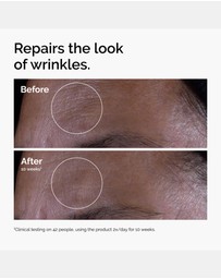 The Ordinary - GF 15% Solution