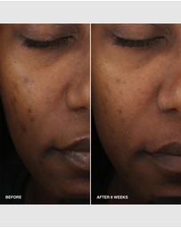 Bobbi Brown - Vitamin Enriched Smoothing Serum
