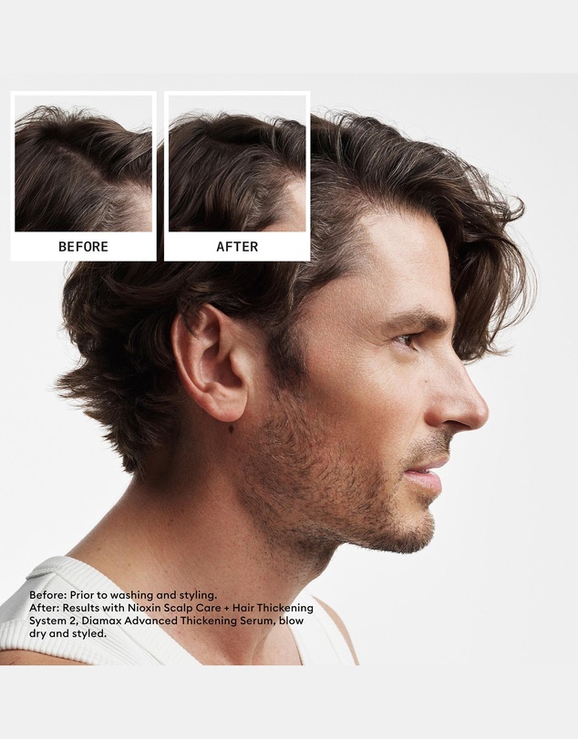 Nioxin - Nioxin Scalp + Hair Thickening System 2 - Hair Thickening System For Natural Hair With Progressed Thinning