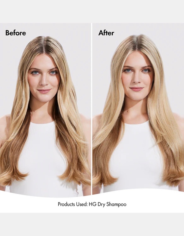 Bondi Boost - Hair Growth Dry Shampoo