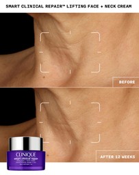 Clinique - Smart Clinical Repair Lifting Face + Neck Cream