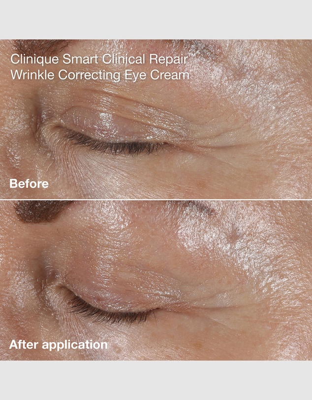 Clinique - Anti-Aging Routine: Mini Smart Clinical Repair Kit