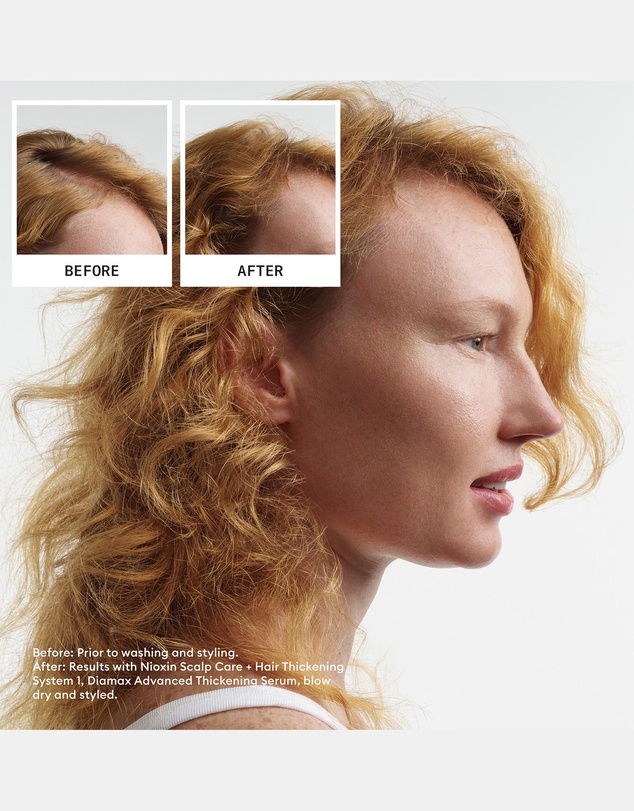 Nioxin - Nioxin Scalp + Hair Thickening System 1 - Hair Thickening System For Natural Hair With Light Thinning- Includes Shampoo, Conditioner And Scalp Treatment