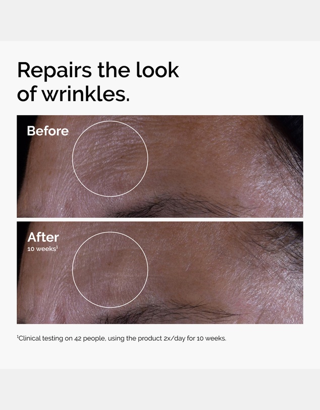 The Ordinary - GF 15% Solution