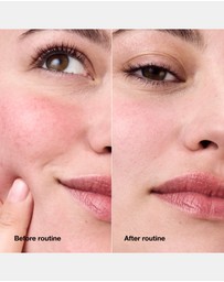 Clinique - Redness Solutions Daily Relief Cream