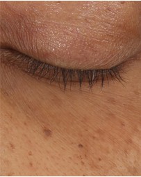 Clinique - All About Eyes Brightening Serum Concentrate