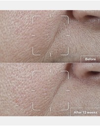 Clinique - Smart Clinical Repair SPF 15 Wrinkle Correcting Cream