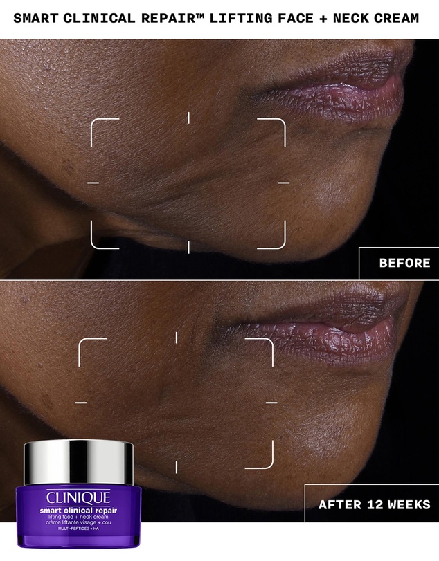 Clinique - Smart Clinical Repair Lifting Face + Neck Cream