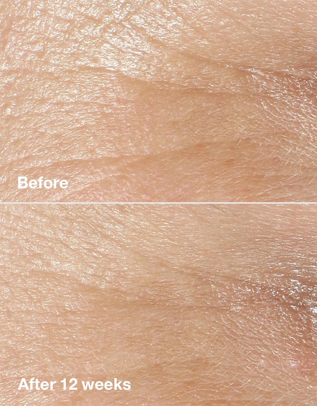 Clinique - Smart Clinical Repair Wrinkle Correcting Cream