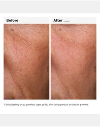 The Ordinary - Hyaluronic Acid 2% + B5