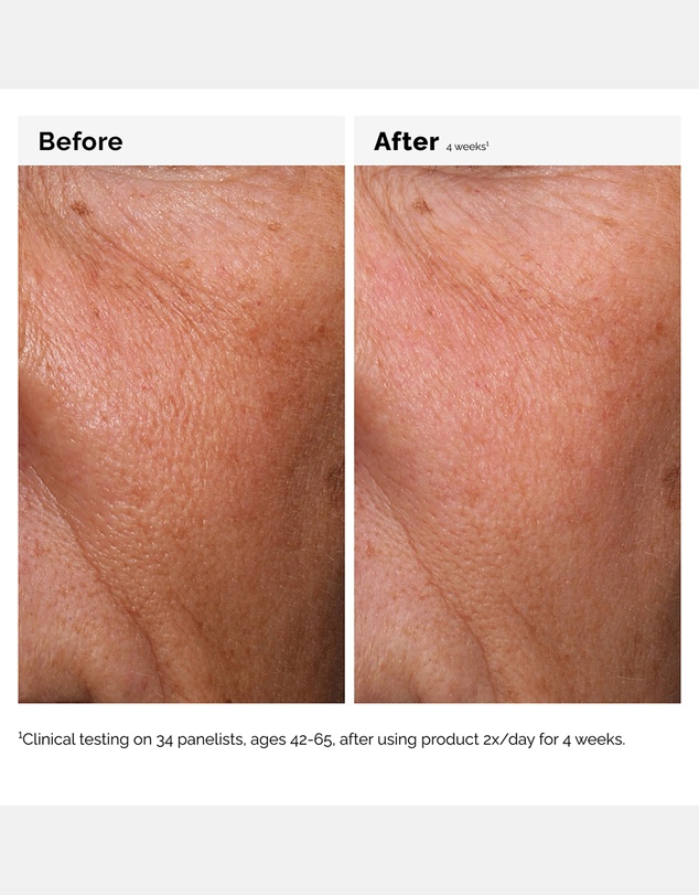 The Ordinary - Hyaluronic Acid 2% + B5