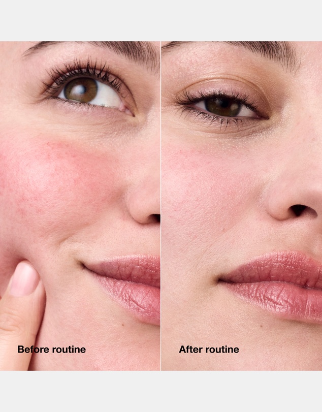 Clinique - Redness Solutions Daily Relief Cream