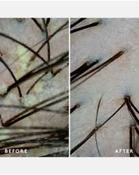 Virtue Labs - Scalp Remedy Conditioner