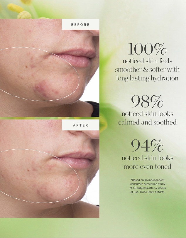 KORA Organics - Active Algae Lightweight Moisturiser 15ml