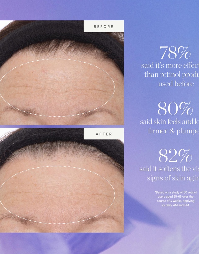 KORA Organics - Plant Stem Cell Retinol Alternative Serum