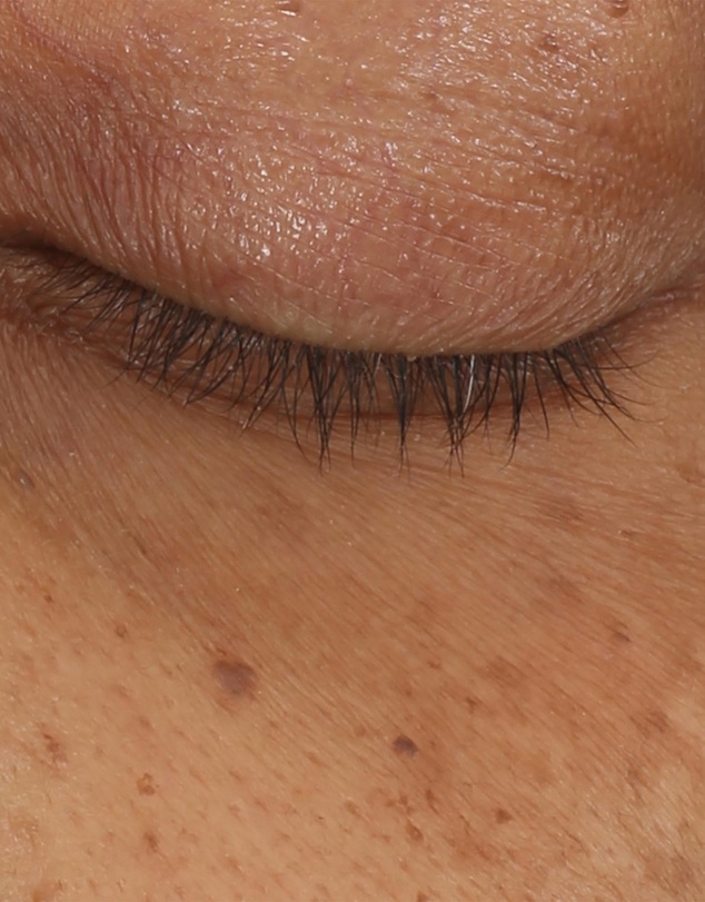 Clinique - All About Eyes Brightening Serum Concentrate