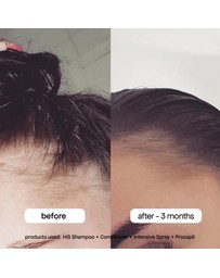 Bondi Boost - Anti-Thinning Procapil® Scalp Tonic