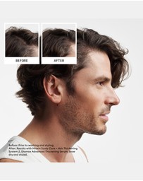 Nioxin - Nioxin Scalp + Hair Thickening System 2 - Hair Thickening System For Natural Hair With Progressed Thinning