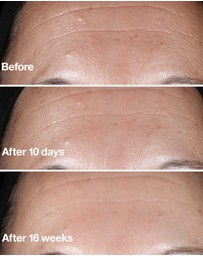 Clinique - Smart Clinical Repair Wrinkle Correcting Serum